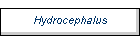 Hydrocephalus